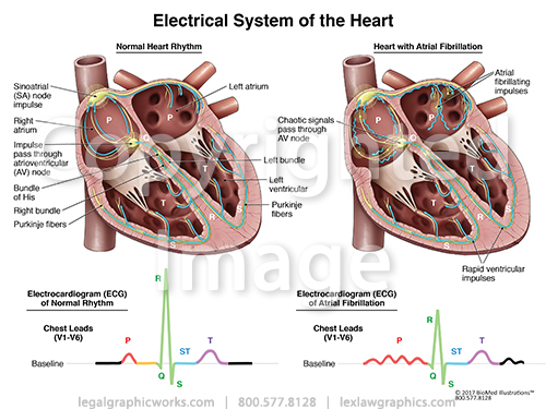 electrical system of the heart